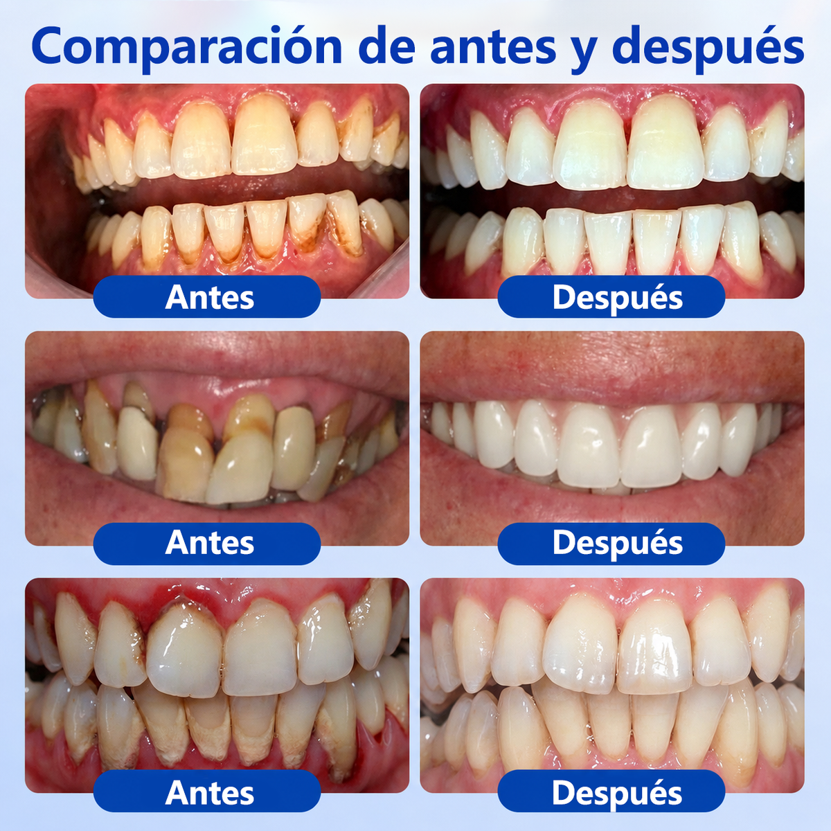 🥇𝑮𝒍𝒊𝒎𝒎𝒆𝒓𝒍𝒚® 𝑮𝒖𝒎𝑹𝒆𝒗𝒊𝒗𝒆 𝑮𝒆𝒍 𝑹𝒆𝒑𝒂𝒓𝒂𝒅𝒐𝒓 𝑷𝒆𝒓𝒊𝒐𝒅𝒐𝒏𝒕𝒂𝒍