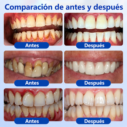 🥇𝑮𝒍𝒊𝒎𝒎𝒆𝒓𝒍𝒚® 𝑮𝒖𝒎𝑹𝒆𝒗𝒊𝒗𝒆 𝑮𝒆𝒍 𝑹𝒆𝒑𝒂𝒓𝒂𝒅𝒐𝒓 𝑷𝒆𝒓𝒊𝒐𝒅𝒐𝒏𝒕𝒂𝒍