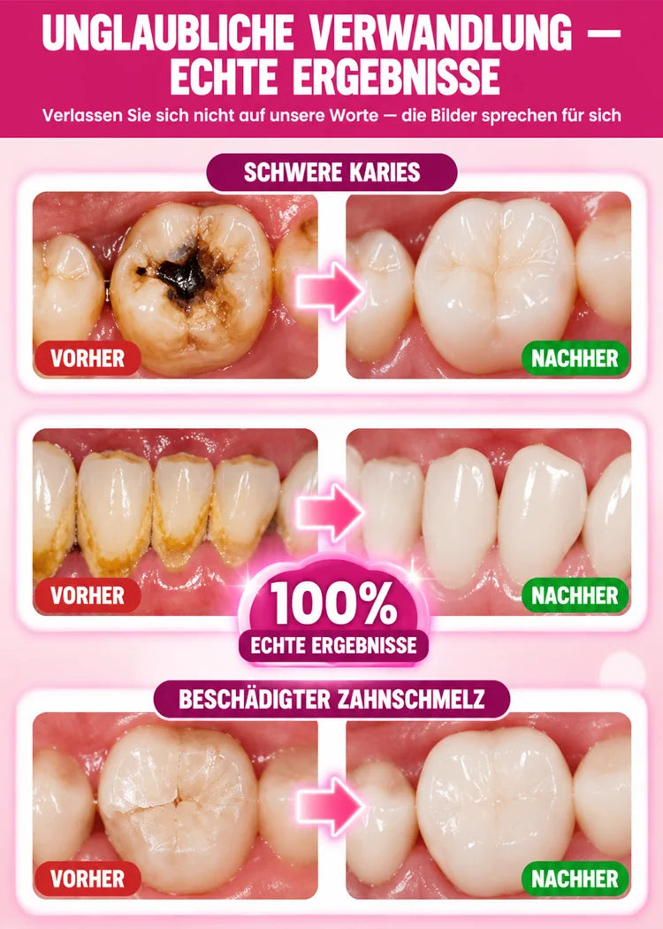 🦷 Dental Care Enamel-Filling Gel