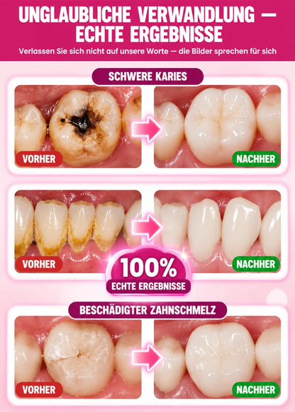 🦷 Dental Care Enamel-Filling Gel