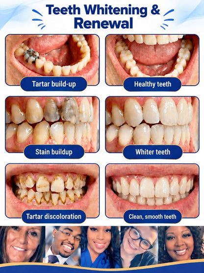 🔥50% OFF🦷Anti-cavity repair and natural enamel-filling agent Kit
