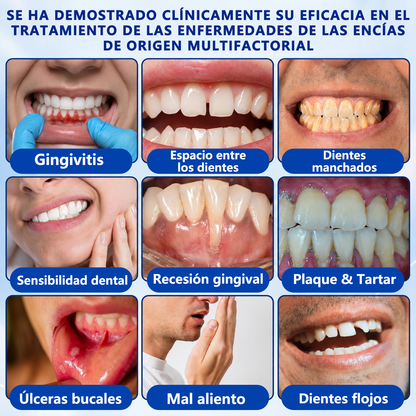 🥇𝑮𝒍𝒊𝒎𝒎𝒆𝒓𝒍𝒚® 𝑮𝒖𝒎𝑹𝒆𝒗𝒊𝒗𝒆 𝑮𝒆𝒍 𝑹𝒆𝒑𝒂𝒓𝒂𝒅𝒐𝒓 𝑷𝒆𝒓𝒊𝒐𝒅𝒐𝒏𝒕𝒂𝒍