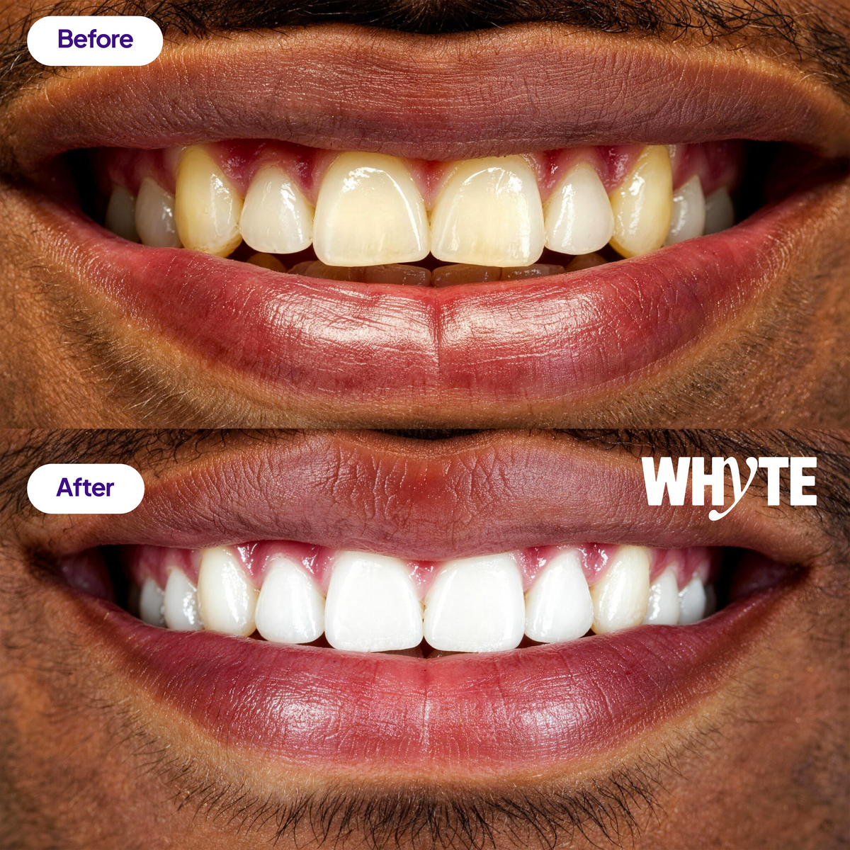 💜Purple Teeth Whitening Powder🦷