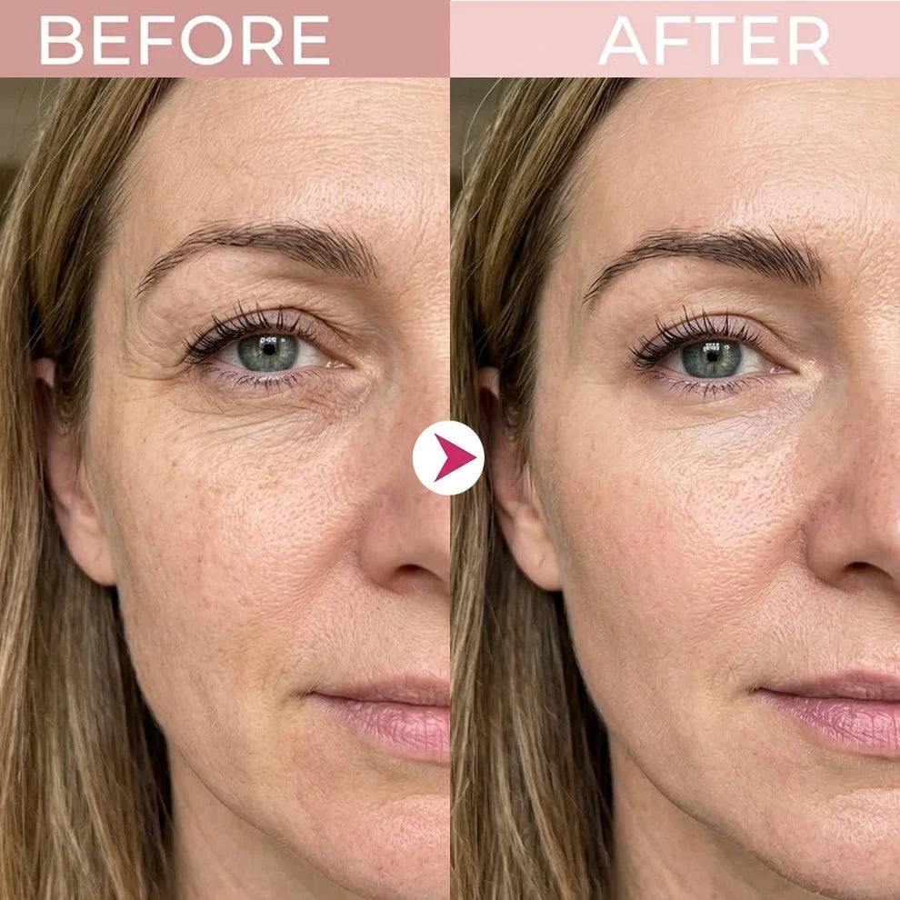 🔥Final 2 Hour 50% OFF🔥 P7 Eye Renewal Crème