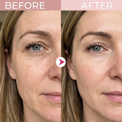 🔥Final 2 Hour 50% OFF🔥 P7 Eye Renewal Crème