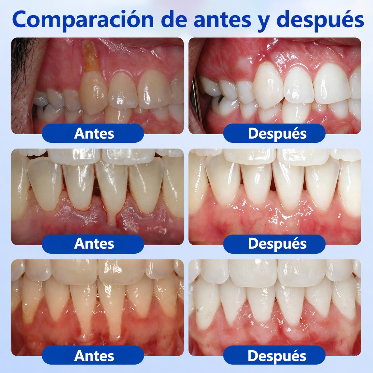 🥇𝑮𝒍𝒊𝒎𝒎𝒆𝒓𝒍𝒚® 𝑮𝒖𝒎𝑹𝒆𝒗𝒊𝒗𝒆 𝑮𝒆𝒍 𝑹𝒆𝒑𝒂𝒓𝒂𝒅𝒐𝒓 𝑷𝒆𝒓𝒊𝒐𝒅𝒐𝒏𝒕𝒂𝒍