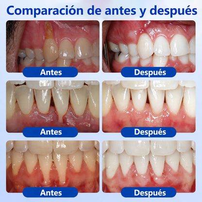 🥇𝑮𝒍𝒊𝒎𝒎𝒆𝒓𝒍𝒚® 𝑮𝒖𝒎𝑹𝒆𝒗𝒊𝒗𝒆 𝑮𝒆𝒍 𝑹𝒆𝒑𝒂𝒓𝒂𝒅𝒐𝒓 𝑷𝒆𝒓𝒊𝒐𝒅𝒐𝒏𝒕𝒂𝒍