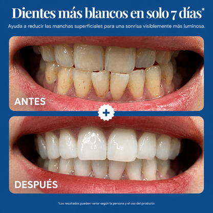 Velydent – Polvo Blanqueador Dental
