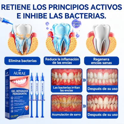 🥇𝑮𝒍𝒊𝒎𝒎𝒆𝒓𝒍𝒚® 𝑮𝒖𝒎𝑹𝒆𝒗𝒊𝒗𝒆 𝑮𝒆𝒍 𝑹𝒆𝒑𝒂𝒓𝒂𝒅𝒐𝒓 𝑷𝒆𝒓𝒊𝒐𝒅𝒐𝒏𝒕𝒂𝒍