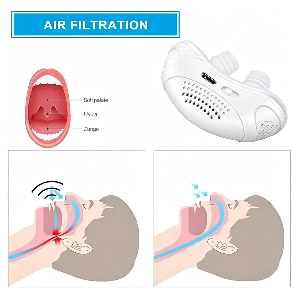 🔥The First Hoseless, Maskless, Micro-CPAP Anti Snoring