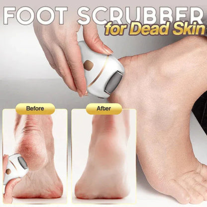 ⏳ Limited-time offer⏳ Rechargeable electric foot file for calluses Two speeds and removable grinding head USB charging Available