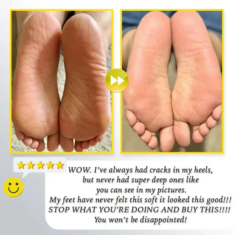 ⏳ Limited-time offer⏳ Rechargeable electric foot file for calluses Two speeds and removable grinding head USB charging Available