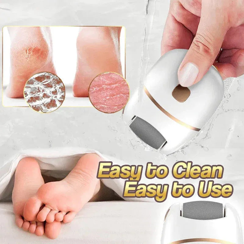 ⏳ Limited-time offer⏳ Rechargeable electric foot file for calluses Two speeds and removable grinding head USB charging Available