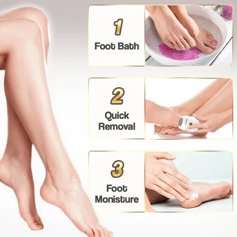 ⏳ Limited-time offer⏳ Rechargeable electric foot file for calluses Two speeds and removable grinding head USB charging Available