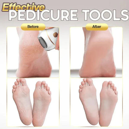 ⏳ Limited-time offer⏳ Rechargeable electric foot file for calluses Two speeds and removable grinding head USB charging Available